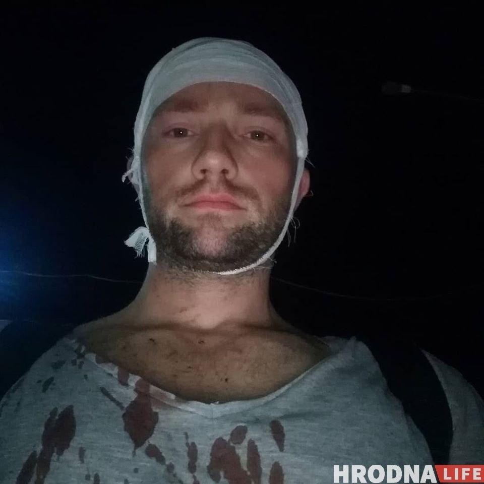 «Прыйшлося выдаліць вока», «кідалі ўніз галавой», «на спіне таблічка ў крыжыкі-нулікі». Медыкі з Гродна - аб траўмах пацярпелых ад АМАПа