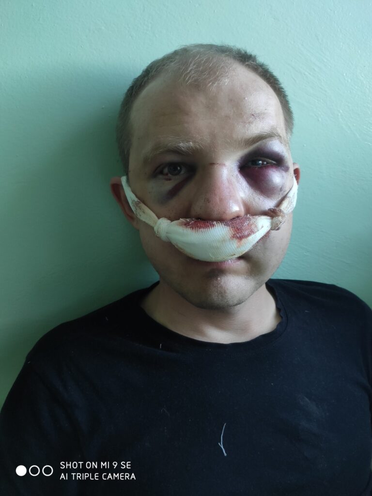 У Гродне пачалі судзіць таксіста, якога збіў АМАП. Пацярпелых двое, у аднаго - некалькі сінякоў