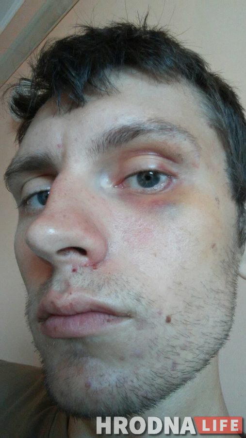 «Они меня избивали, а теперь приглашают работать». Осужденному во время протестов гродненцу пришло приглашение работать в милиции